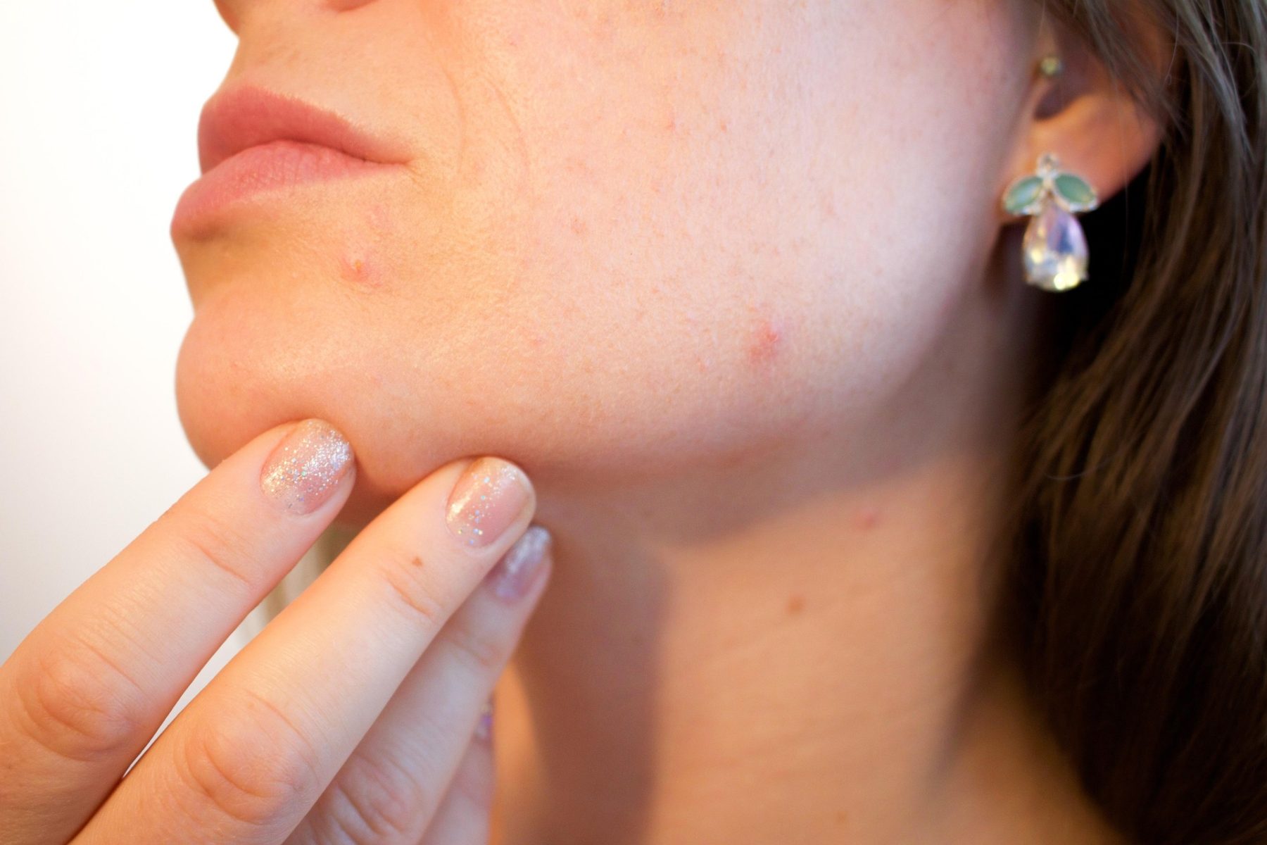 Un avis dermato en 48 heures à la pharmacie : six officines du Gard rhodanien dans le mouvement
